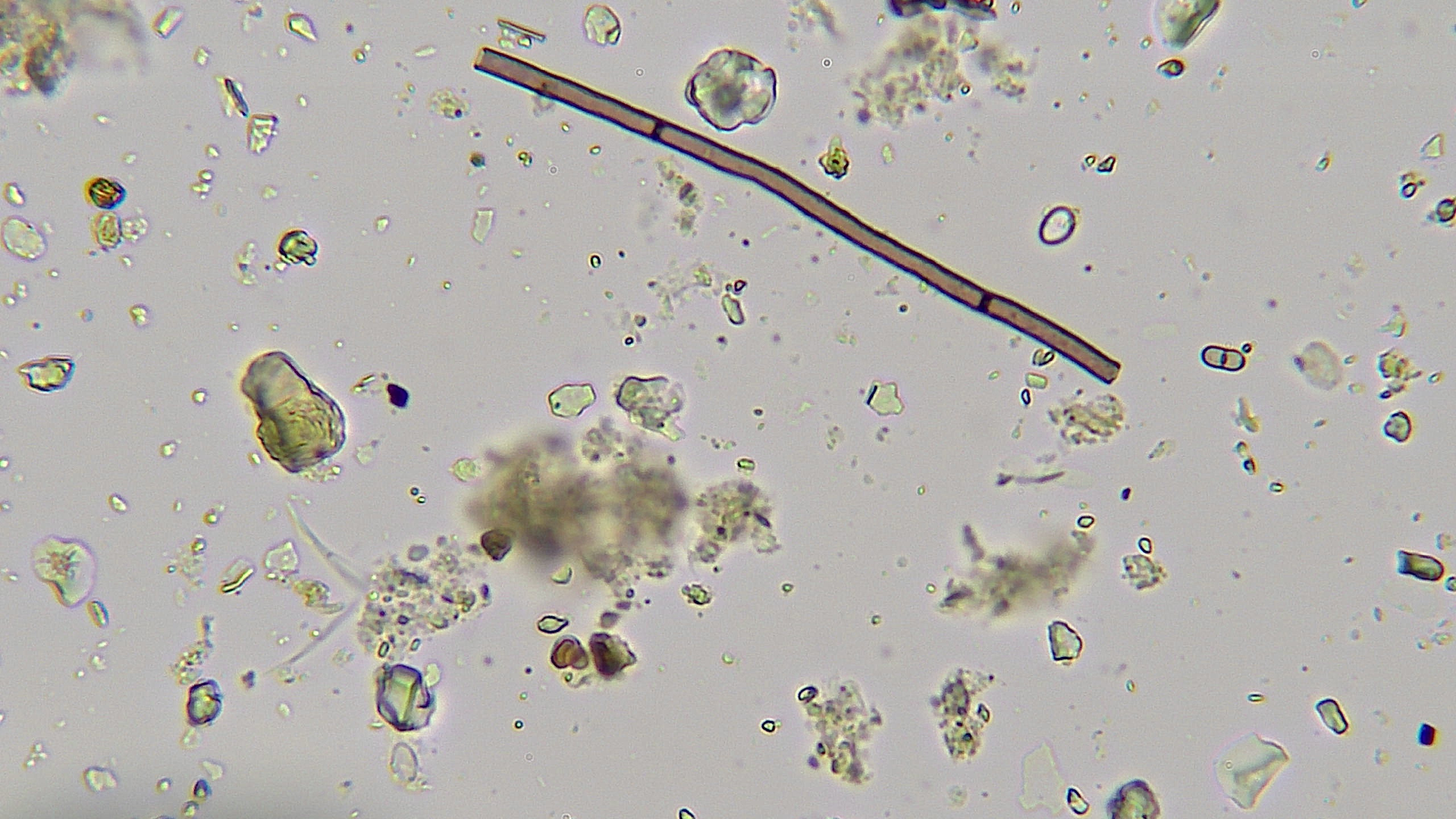 Jordboende svamp set gennem et mikroskop