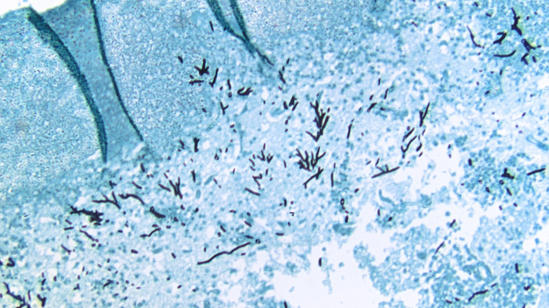 Mikroskopisk foto af svampen Aspergillus fumigatus, der har inficeret en fugls hjerne